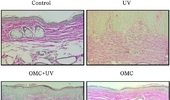 CJK 2024년 9월호 [박사학위 논문] 옥틸메톡시신나메이트(OMC) 자외선B 유도 광노화 억제
