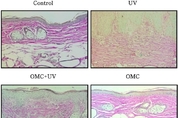 CJK 2024년 9월호 [박사학위 논문] 옥틸메톡시신나메이트(OMC) 자외선B 유도 광노화 억제