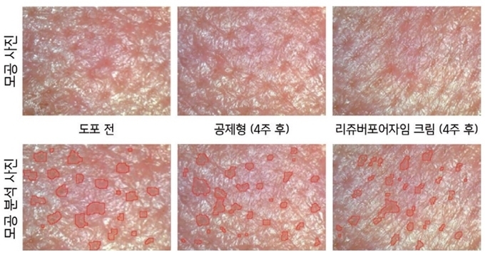 [최신연구] 모공케어 위한 피부 재생, 노화 방지 탁월한 천연 단백질 기반 성분 RejuviPoreZyme 개발